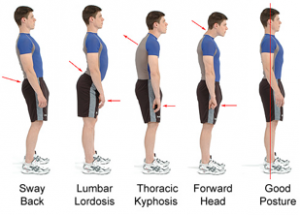 Bad-Posture-Examples